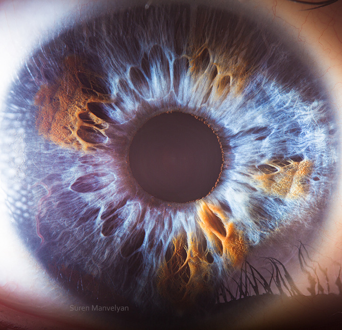 Ojos azules iridología ¿Qué es? -> ¿Qué es la iridología de ojos azules?